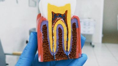 Is It Painful to Have a Root Canal?