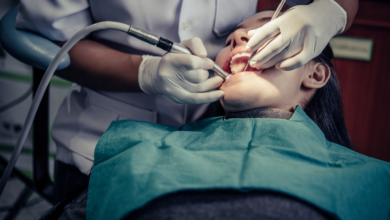 Why Dental Crowns Are Often Needed After Root Canals